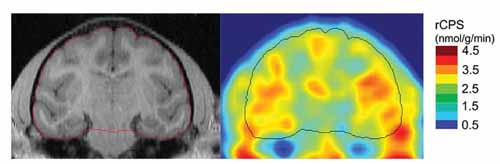 secondary somatosensory cortex